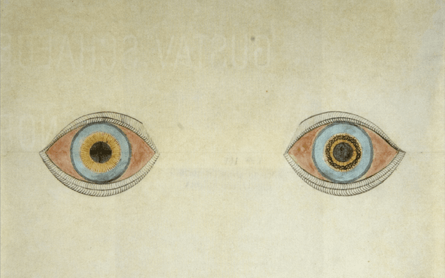 AI 幻觉 (Hallucination)
